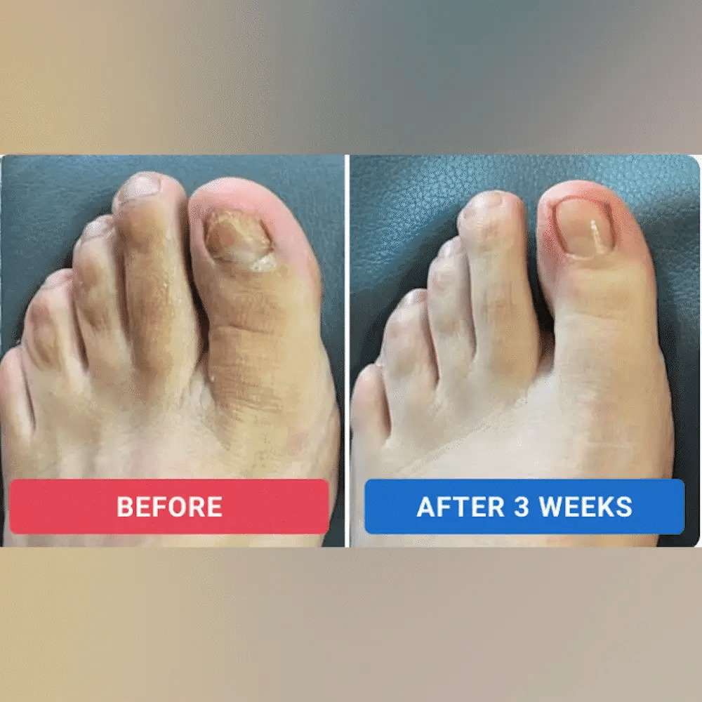 Rediscover Joy and Confidence Wake Up to Beautiful Stronger, Healthier Nails!
